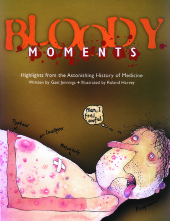 Bloody Moments - and further highlights from the astonishing history of medicine